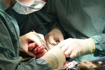 Операция Уиппла при раке поджелудочной железы в Израиле